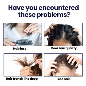 OUHOE Hair Treatment Spray Strengthens Hair, Moisturizes Hair, Improves Dry And Irritated Hair And Hydrates Hair Treatment Spray