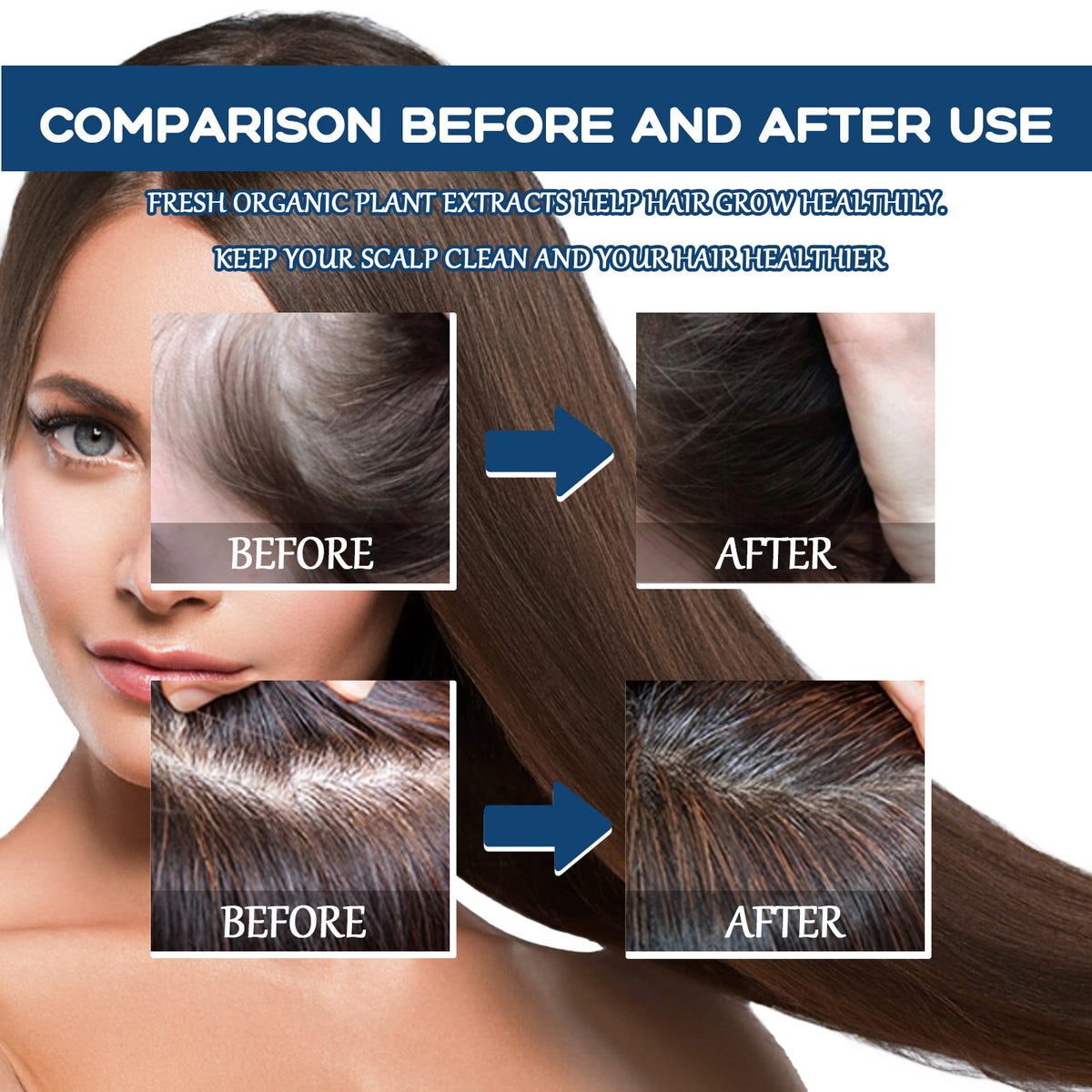 EAST MOON Hair Treatment Spray Moisturizes And Softens Hair, Prevents Loose Hair And Thickens Hair Treatment Spray