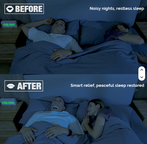 Cloud Flying YA4600 AI Intelligent Breathing Algorithm Throat Massager Snore Stopper